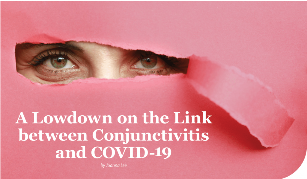 A Lowdown on the Link between Conjunctivitis and COVID19 OasisEye
