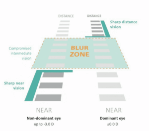 Conventional monovision