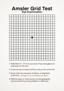 Amsler Grid Test chart used to detect distorted, blurry or missing areas that may indicate macular degeneration.