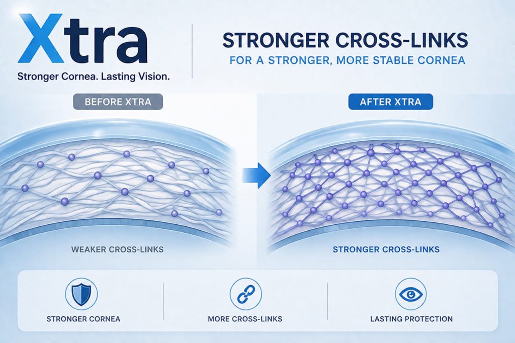 Xtra Corneal Cross-Linking (Xtra)